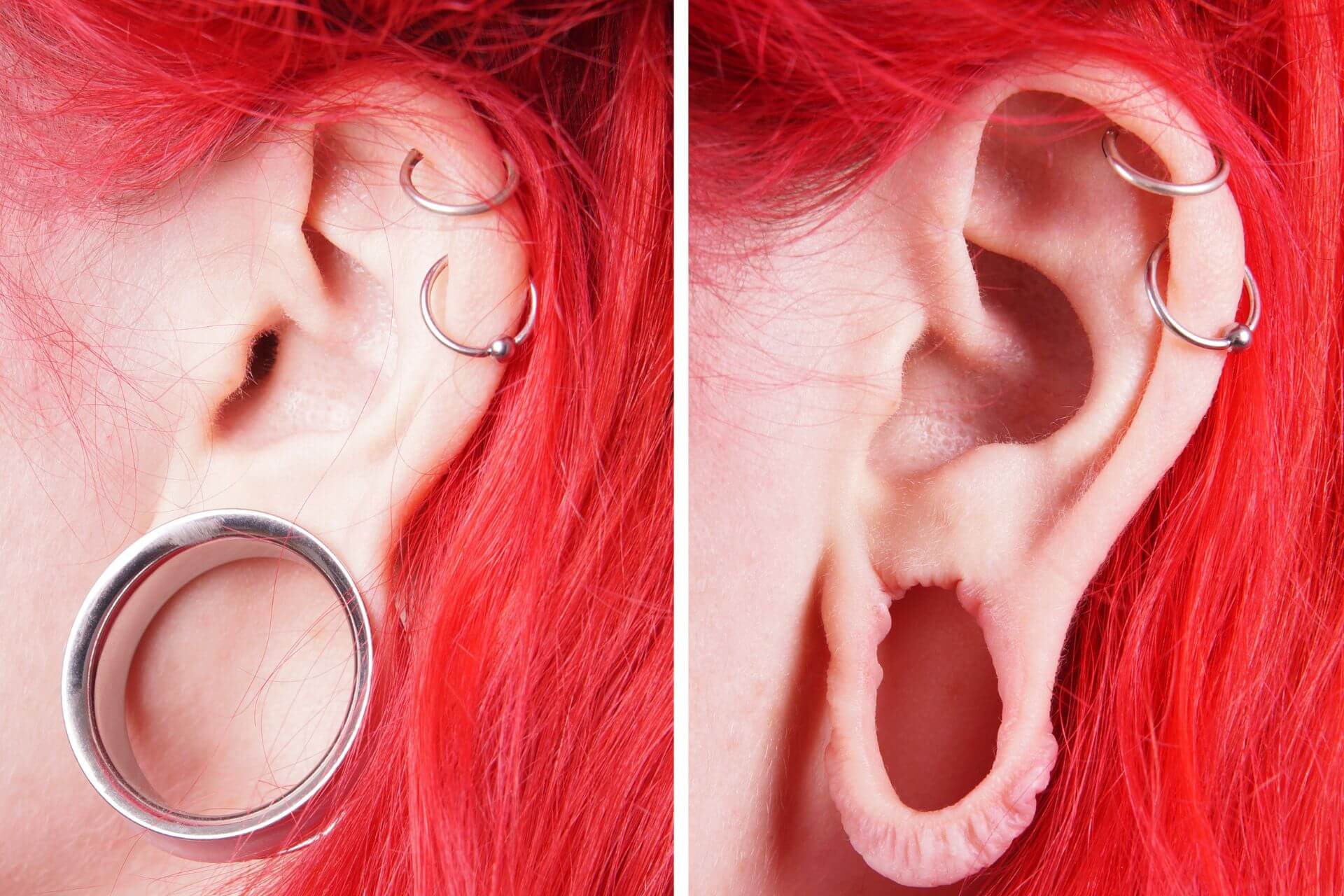 Earlobe Stretched Photo